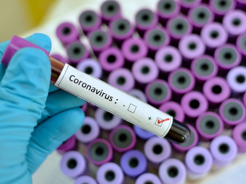 Koronawirus wywołuje chorobę COVID-19 (fot. canva.com)